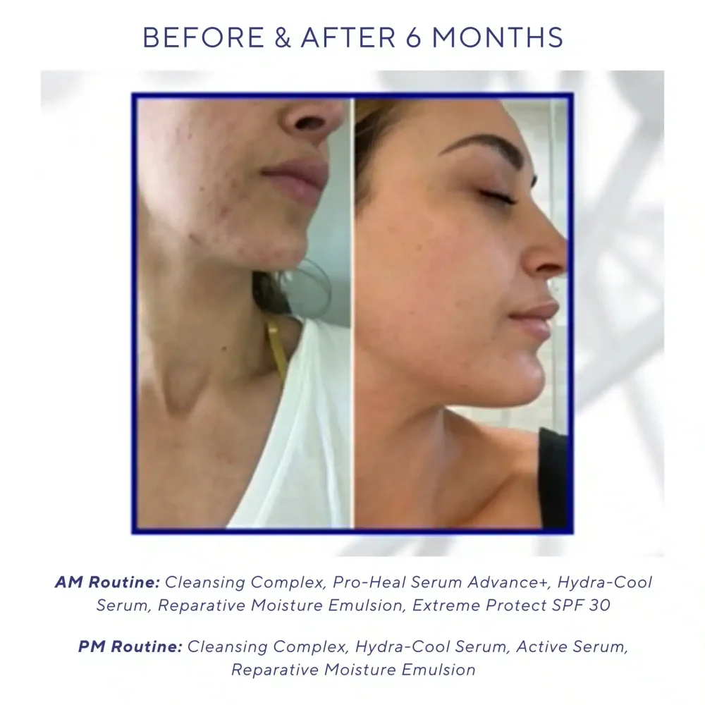 Is clinical – cleansing complex – 60ml | facial cleanser - image 2