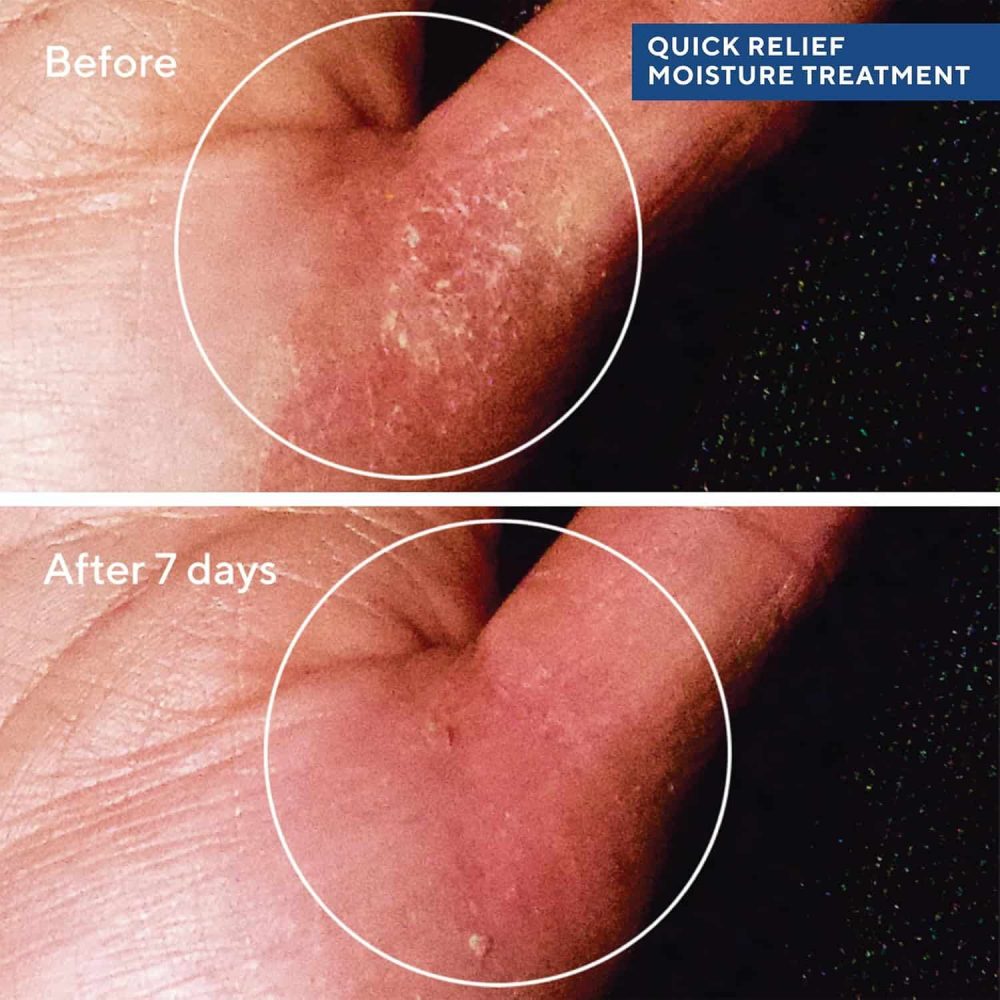 Murad – quick relief moisture treatment - 50ml - image 2