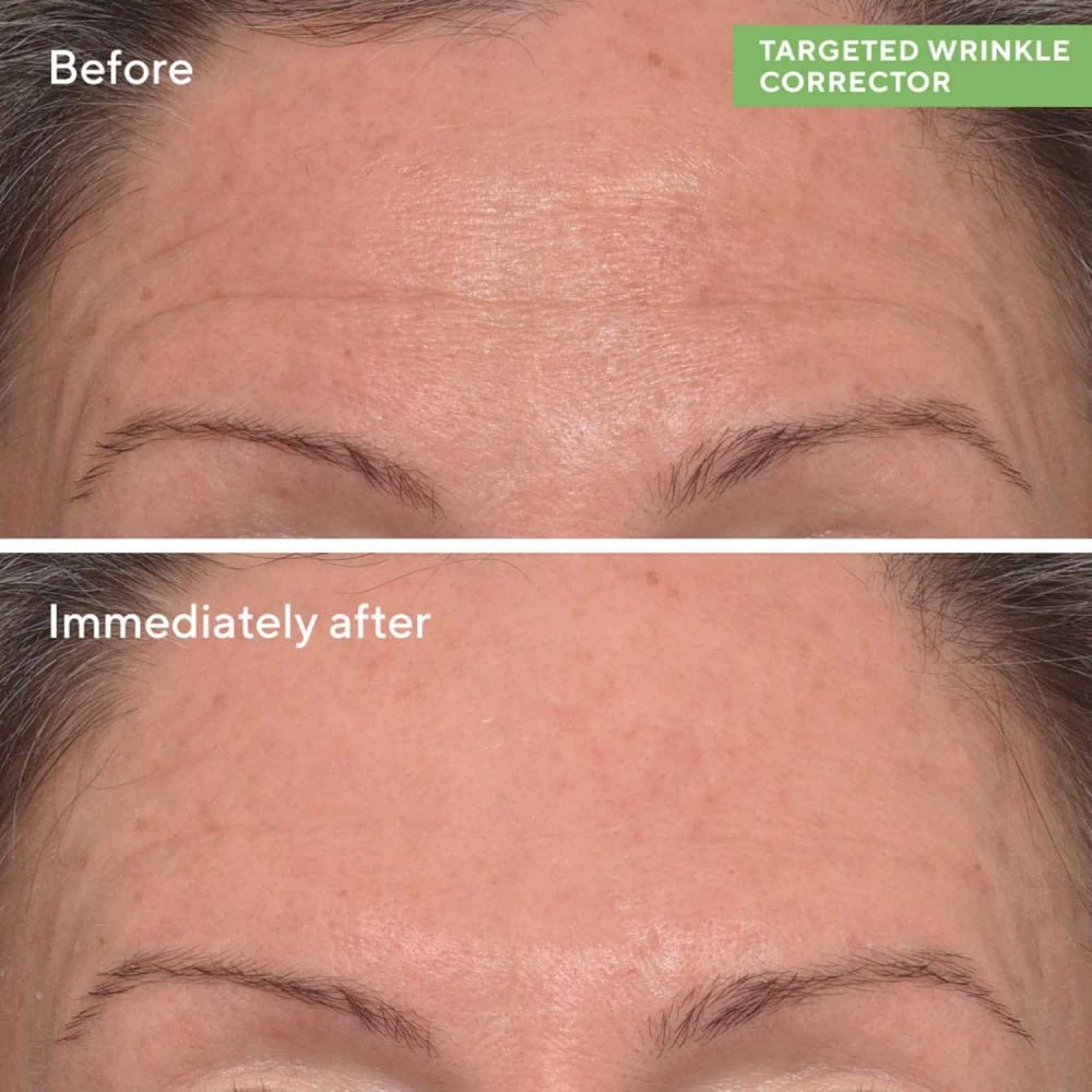 Murad – targeted wrinkle corrector - 15ml - image 8