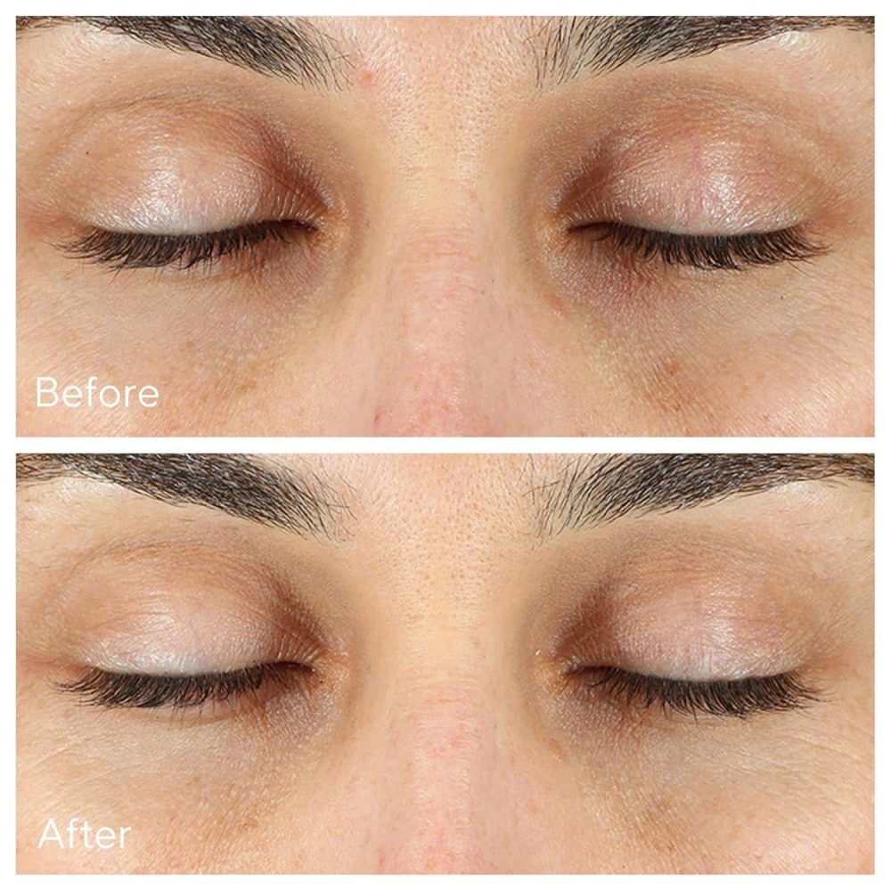 Murad – vita-c eyes dark circle corrector - 15ml - image 6