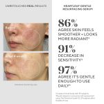MURAD – Heartleaf Gentle Resurfacing Serum - 30ml - Image 9